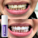 Smilekit Blanqueadora de Dientes